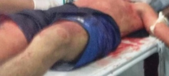 Briga-de-adolescentes-sentenciados-acaba-em-morte