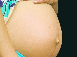 EUA põem 279 grávidas em observação por suspeita de zika