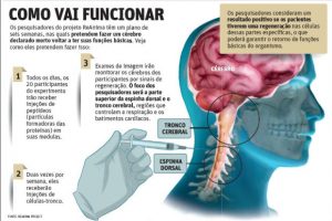 Técnica promete ressuscitar pacientes com morte cerebral