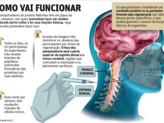 Técnica promete ressuscitar pacientes com morte cerebral