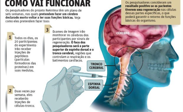 Técnica promete ressuscitar pacientes com morte cerebral