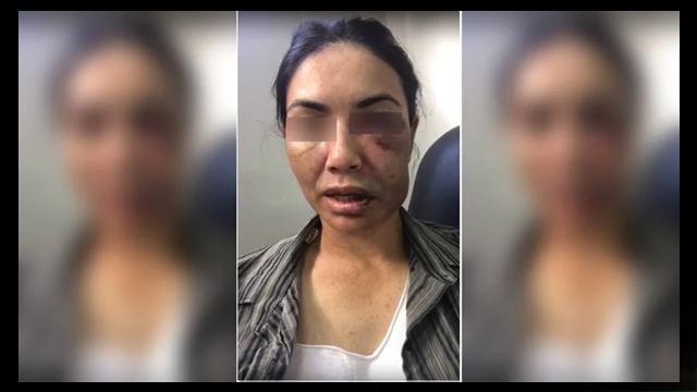 Motorista é jogada de ponte e se finge de morta para fugir de ladrões