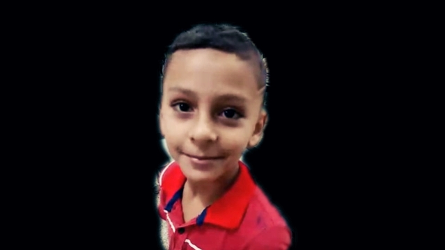 Morre em Curitiba Lukas, a criança atacada por dois pitbull em Rondônia